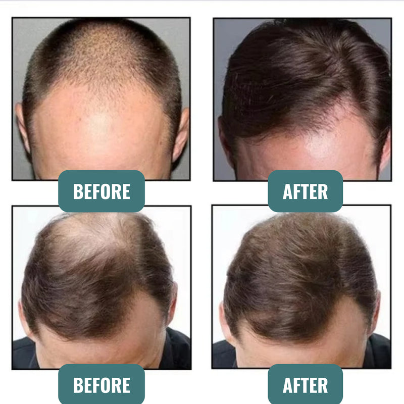 Instant Keratin Hair Fiber – Dickeres Haar in Sekunden 